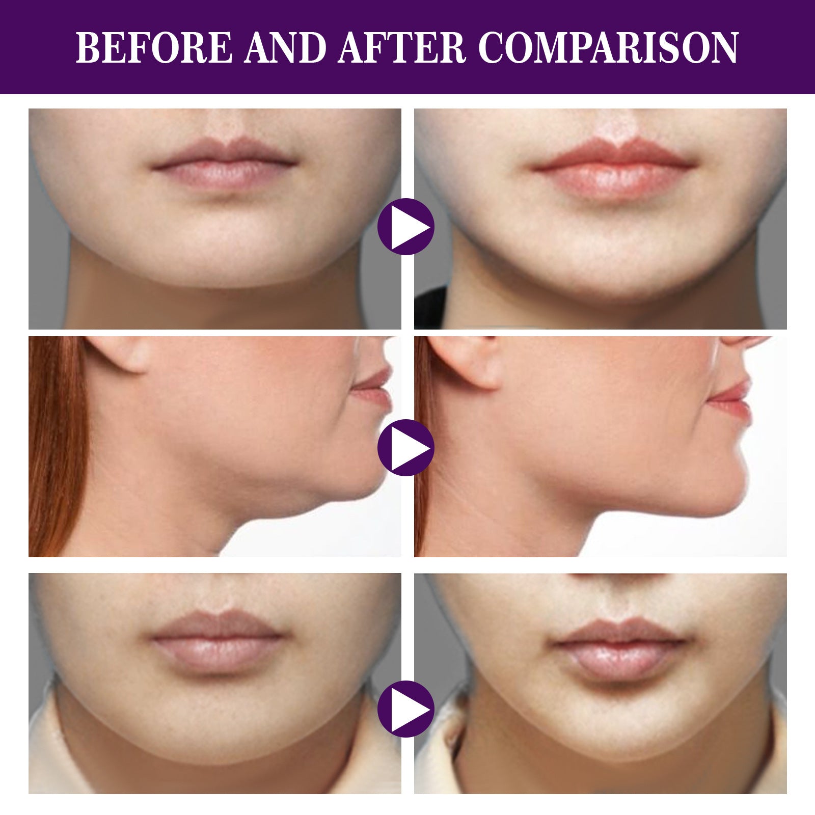 Facial Tightening Double Chin Invisible Lifting Sticker NexBio