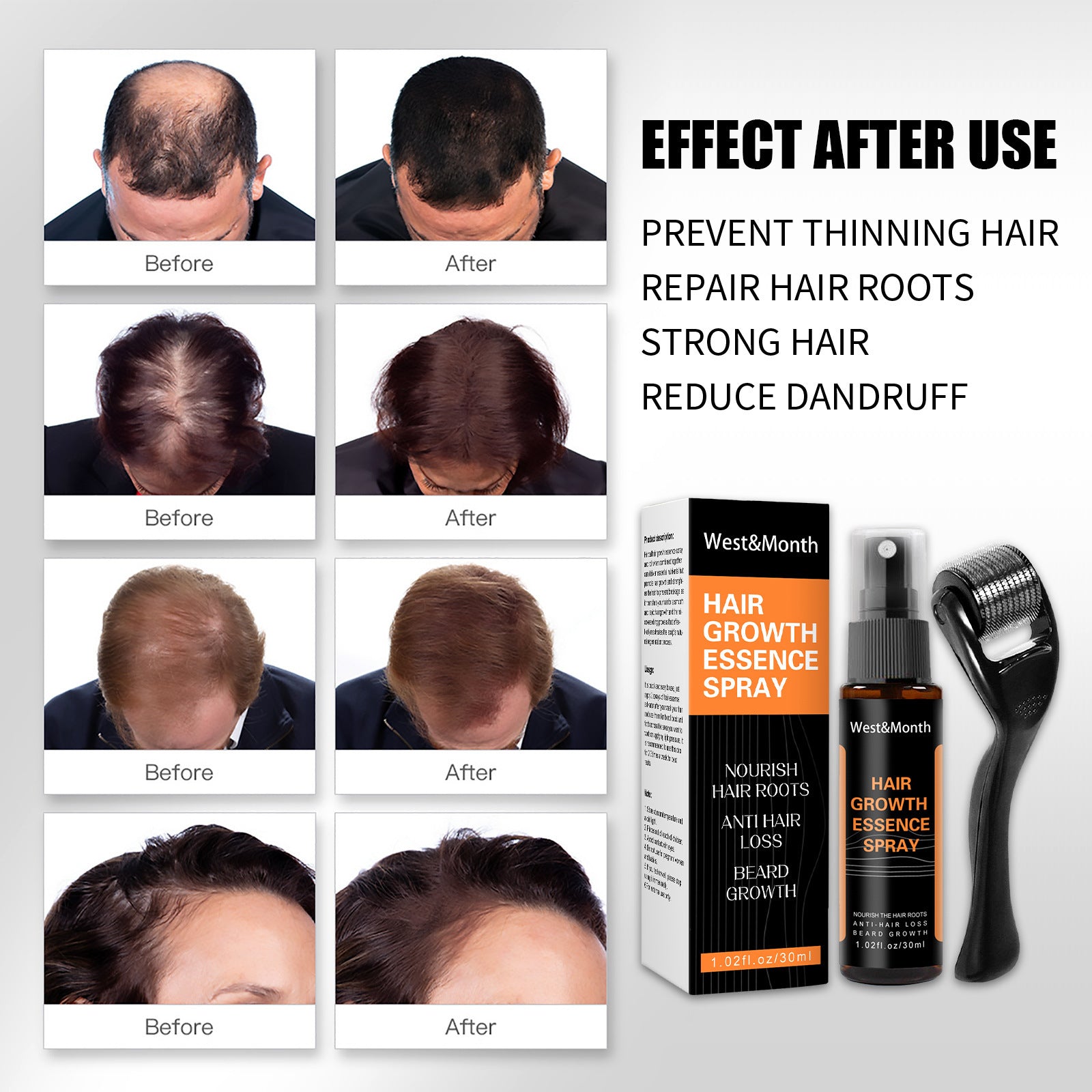 Hair Growth Spray NexBio
