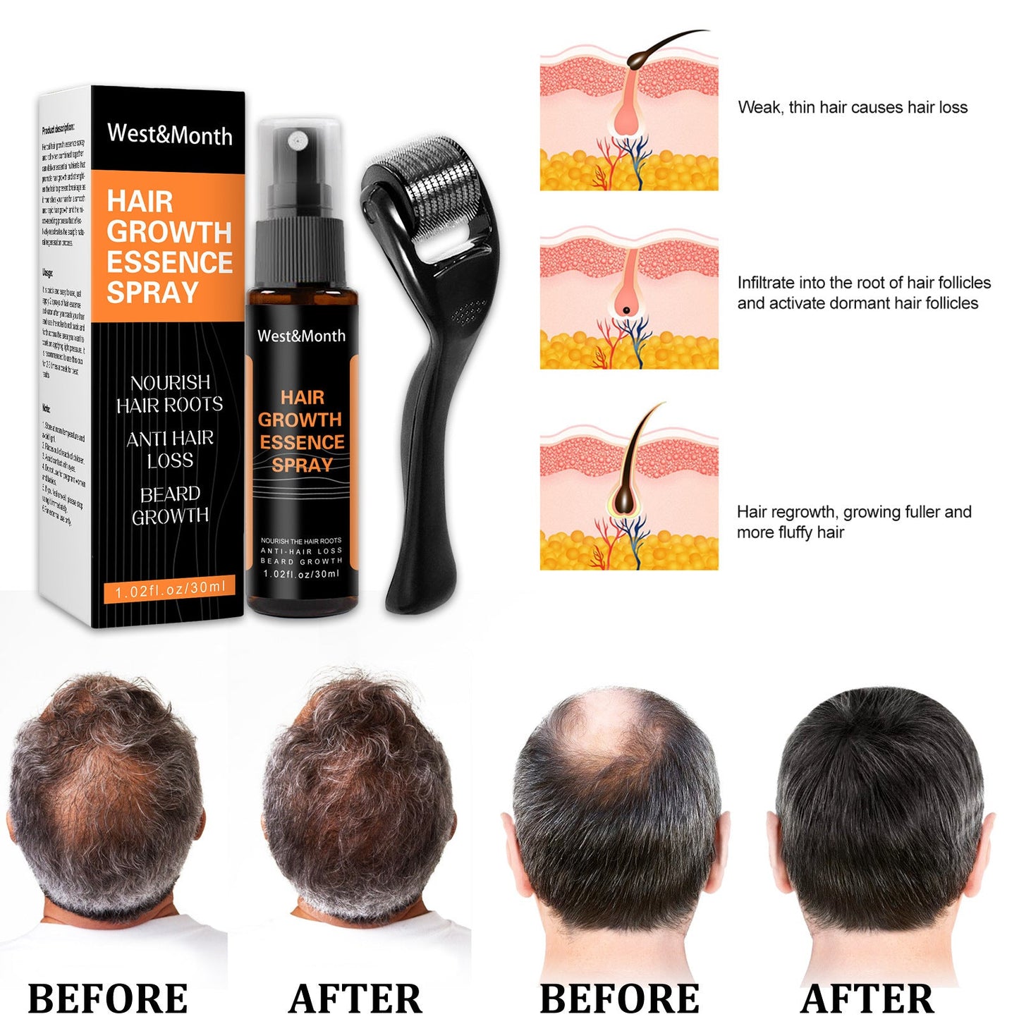 Hair Growth Spray NexBio
