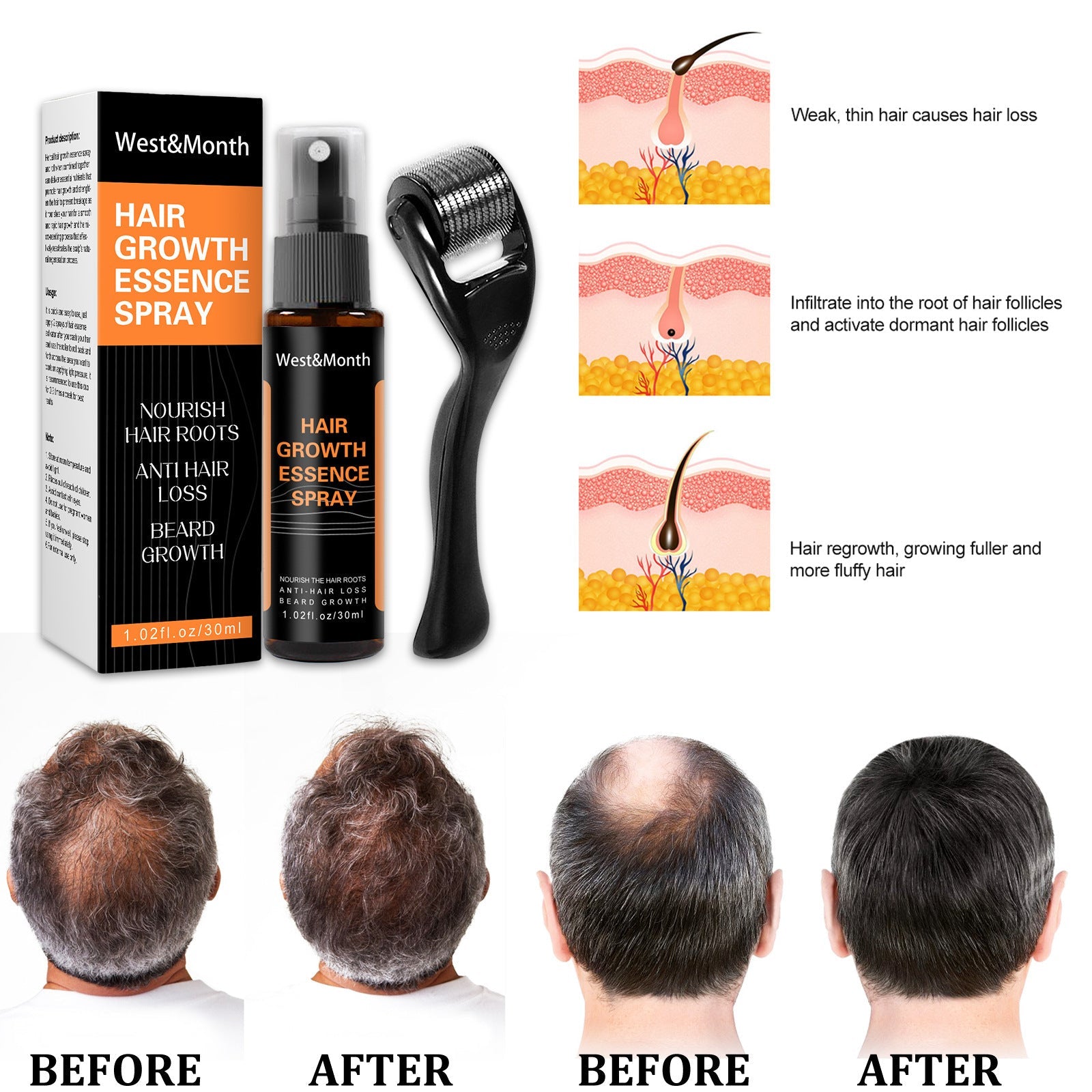Hair Growth Spray NexBio